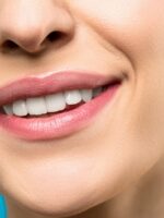 Segredos dos dentes mais brancos