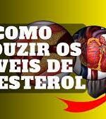 5 Etapas simples para reduzir o nível de colesterol