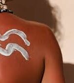 5 maneiras de baixo custo para acalmar queimadura solar